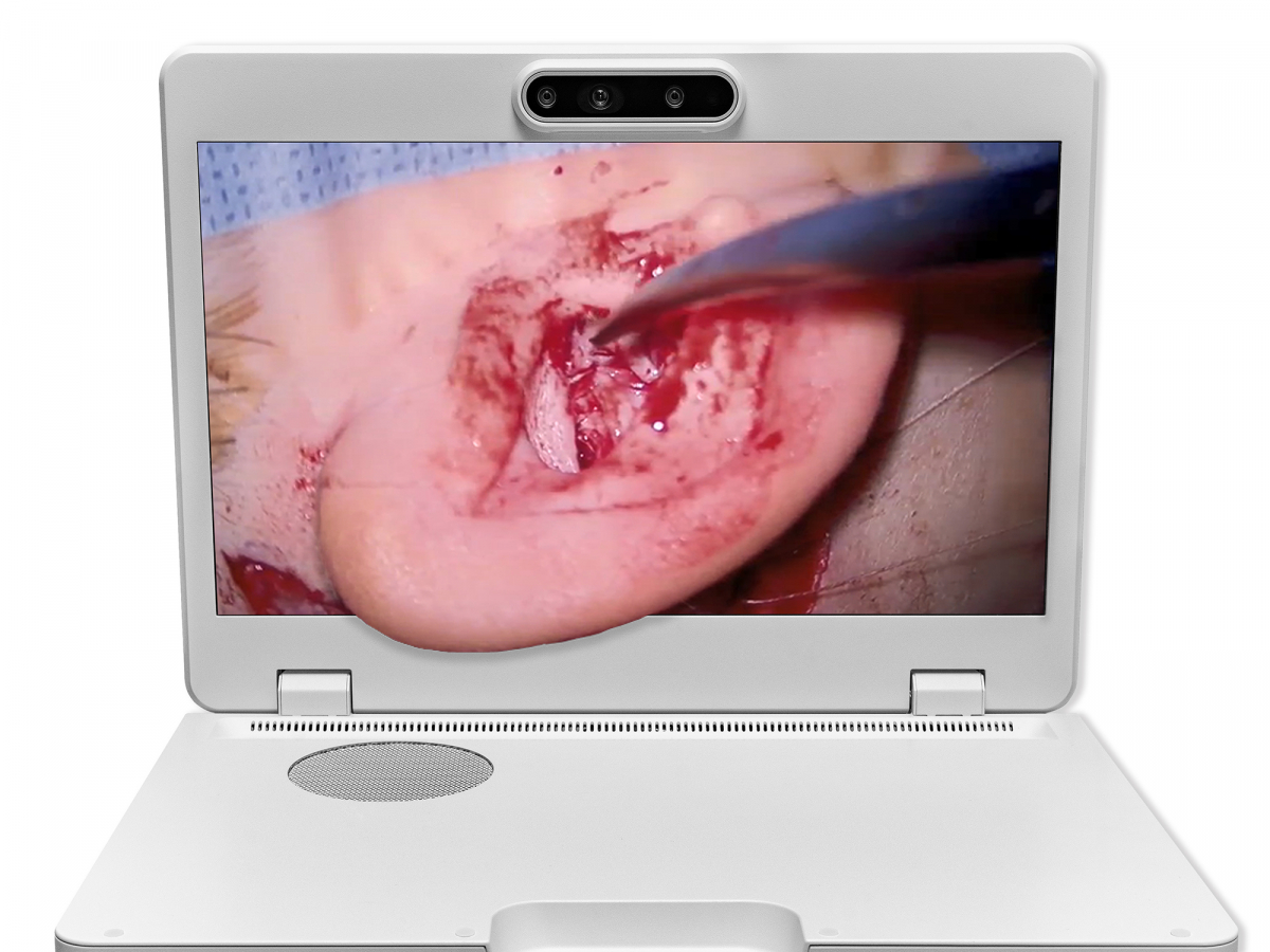 达擎之＂Heads-up 3D显微手术显示系统＂，整合4K裸眼3D显示及眼球追踪系统，具备快速追踪人眼移动位置功能，减轻医师长时间维持固定姿势的负担，让医师能有更宽广清晰的3D立体视野及更舒适的姿势来执行手术。